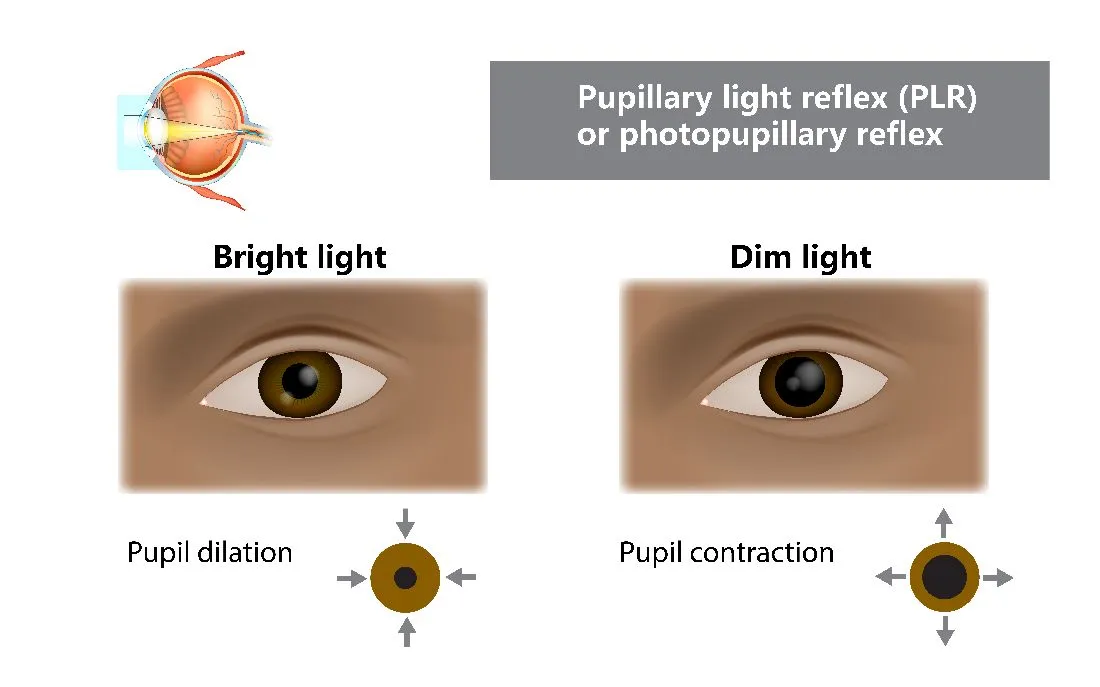 Text: Pupillary light reflex (PLR) or photopupillary reflex. Bright light / pupil dilation, dim light / pupil contraction.