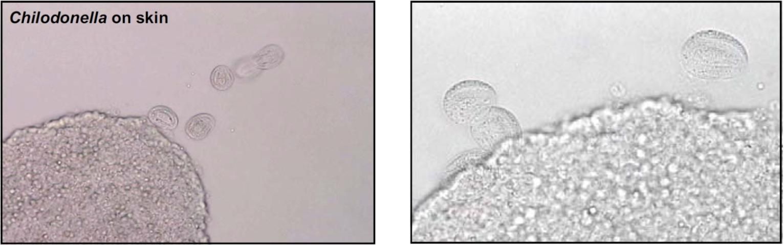 two samples under microscope, the left one labeled "Chilonodella on skin"