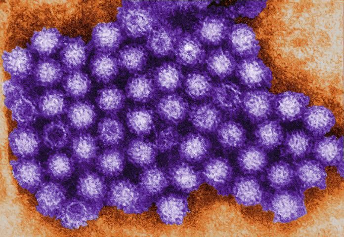 Figure 1. Transmission electron micrograph of norovirus particles