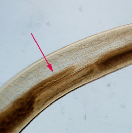 The intestinal cecum (the pouch that connects small and large intestines) of Pseudoterranova decipiens. 