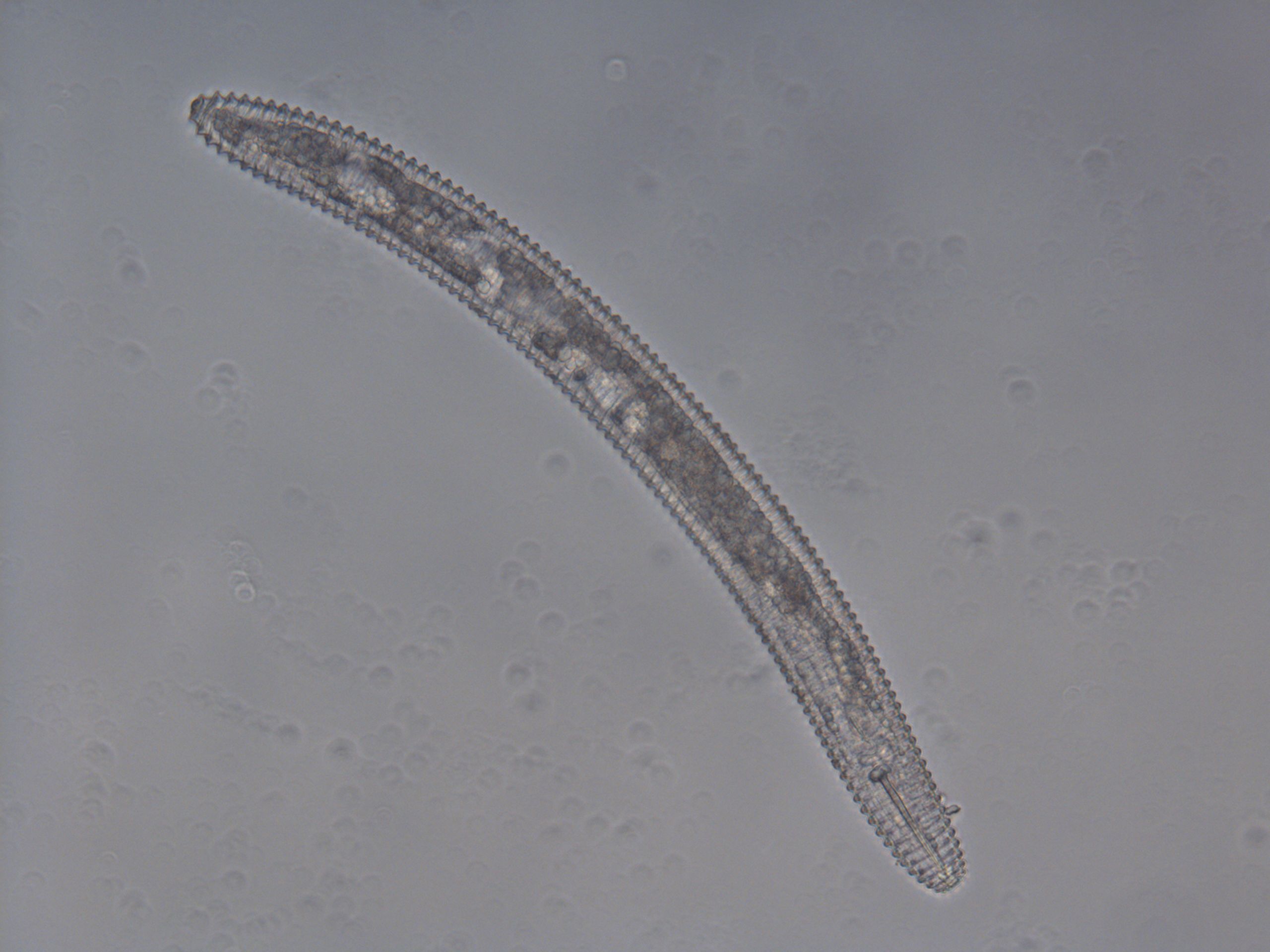 Female Mesocriconema ornatum. The body is cigar-shaped and heavily annulated. 