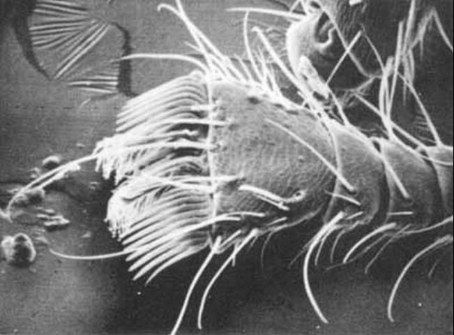 Figure 4. A scanning electron microscope photograph of a dorsal view of a Braula coeca tarsus showing the comb-shaped row of spines, or claw, important in clinging to the branched hairs of the honey bee, Apis mellifera Linnaeus.