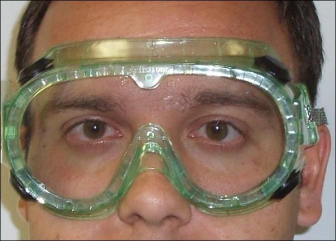 Figure 20. Goggles.