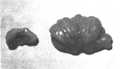 Figure 11. 