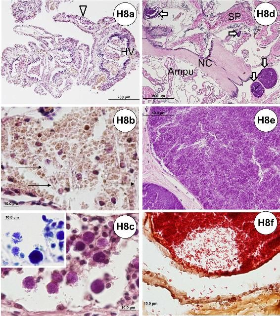 Figure H8-1. Histopathological section of the gill and test. (a) Tangential section of gill. (b) Higher magnification of the hemal vessel of the gill showing needle-like structures (spicule) associated with coelomocyte aggregates. (c) High-power magnification of (a) showing basophilic cellular aggregates (sphere) in hemal vessel. Inset shows Giemsa stain. (d) Bacterial colonies found at the oral side of the test, internally. (e) Bacterial colonies with high-power magnification of (d). (f) Gram-negative, short rod bacteria demonstrated with Gram stain. Ampu = ampullae; Arrows, thin = needle-like objects; Arrow, thick hollow = bacterial colonies; Arrow head, hollow = basophilic cellular aggregates; HV = hemal vessel; NC = nerve cord; Sp = spine.
